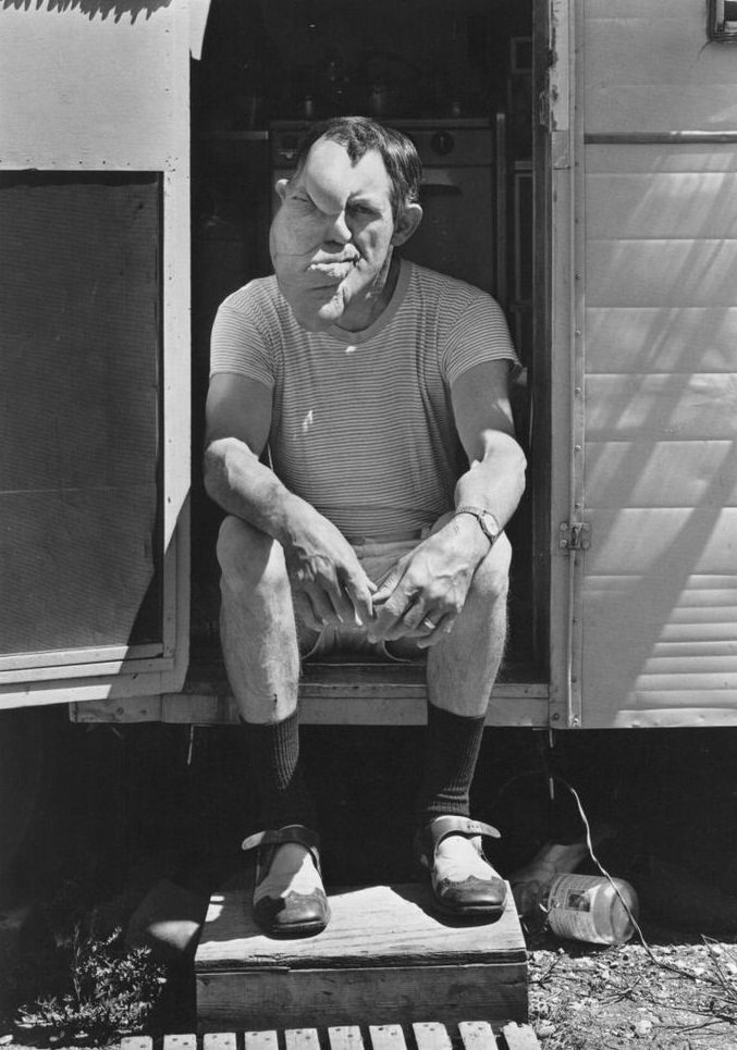 Bob Melvin, who was known as The Man With Two Faces, in his trailer in Fargo, ND, US in 1976.