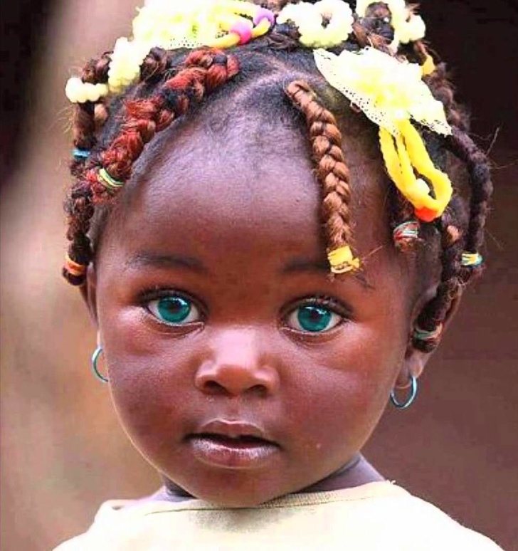 An African girl with an amazing eye color