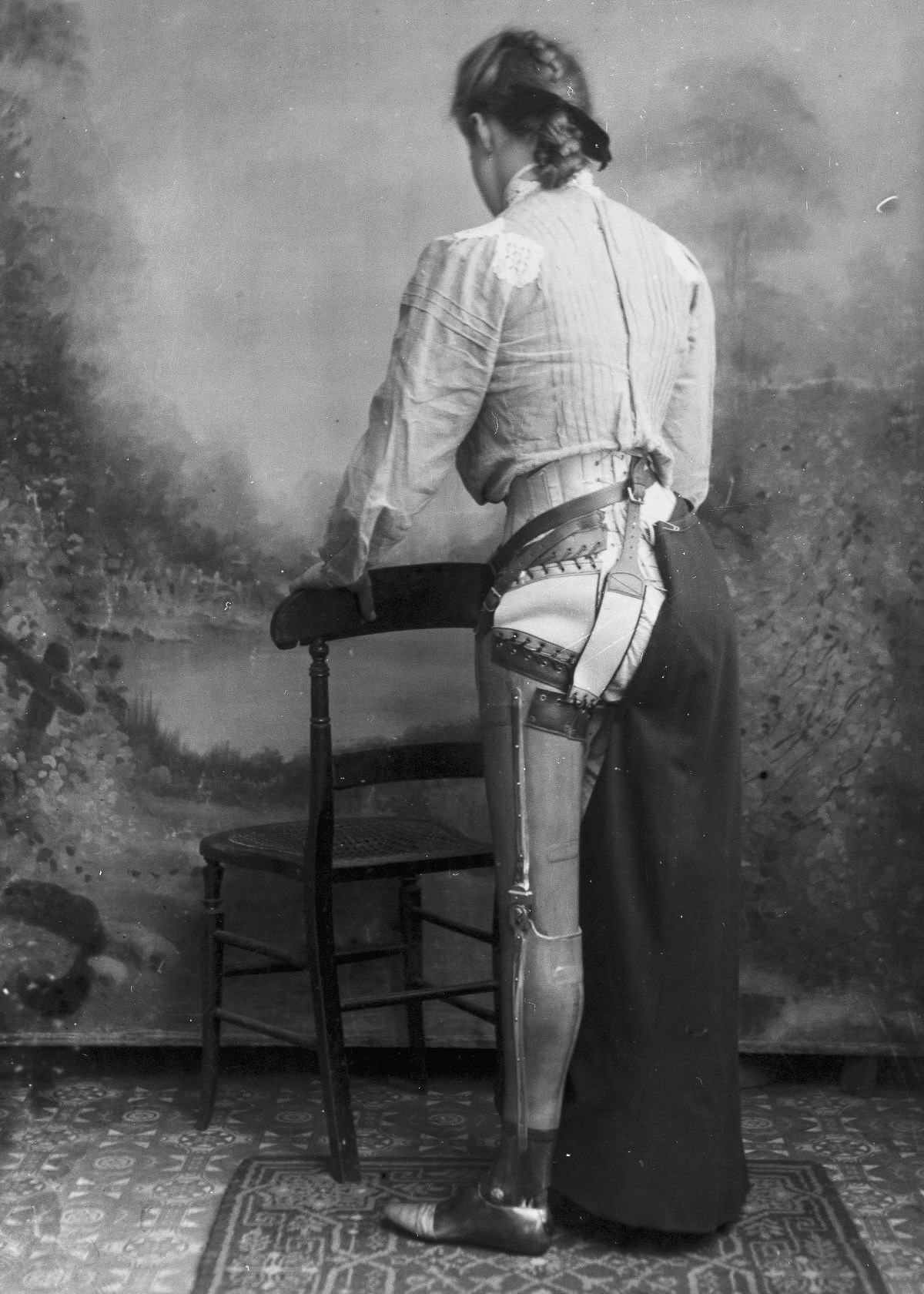 A woman shows off her prosthetic leg in the US in 1900.
