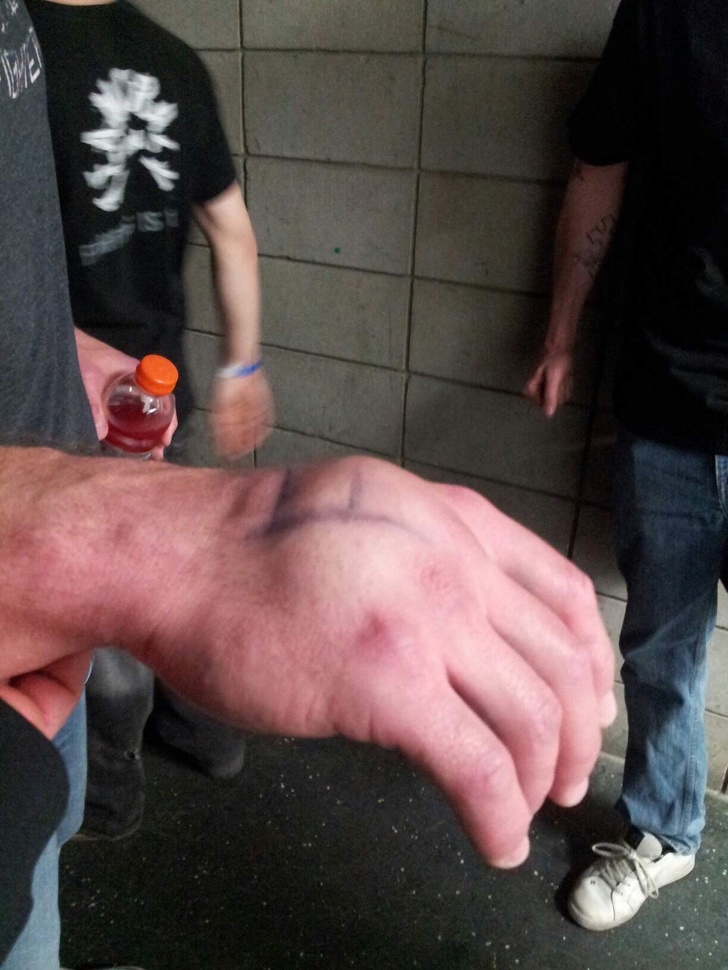 This is a boxer’s hand after knocking out his opponent.