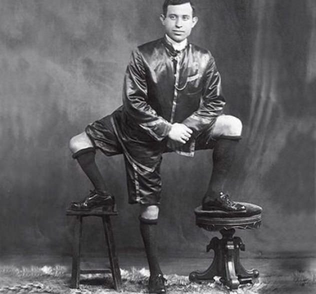 Francesco "Frank" A. Lentini posing for a picture in Italy in 1920. He was with a parasitic twin he absorbed in the womb. He had three legs, four feet and two sets of genitals, and all worked to some extent. He even married in 1907 and had 4 children.