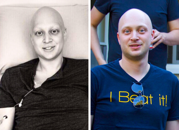 “My husband is 5 years cancer free! Right: last night, left: his last chemotherapy session after 52 weeks of treatment.”
