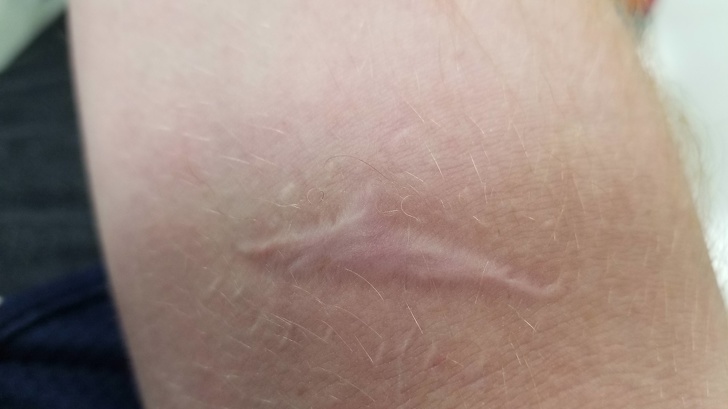 “This scar I got when I was 10 looks like a shark.”