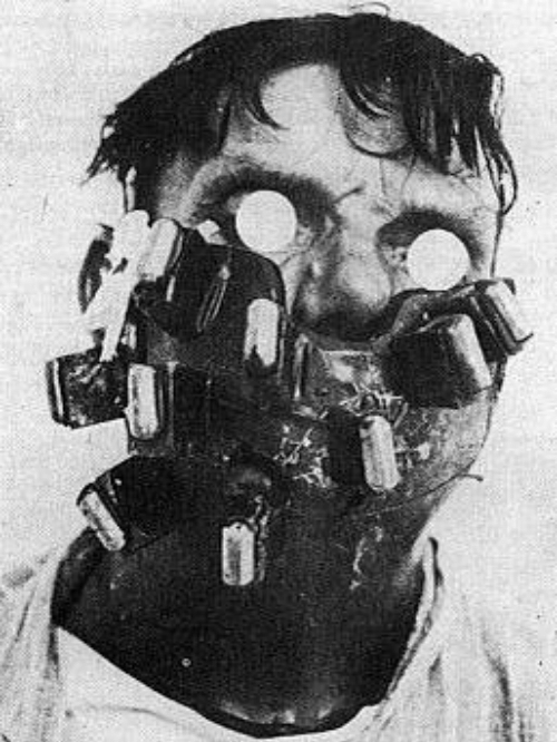 A man in a special mask designed to treat cancer in the face and neck in England in 1924.