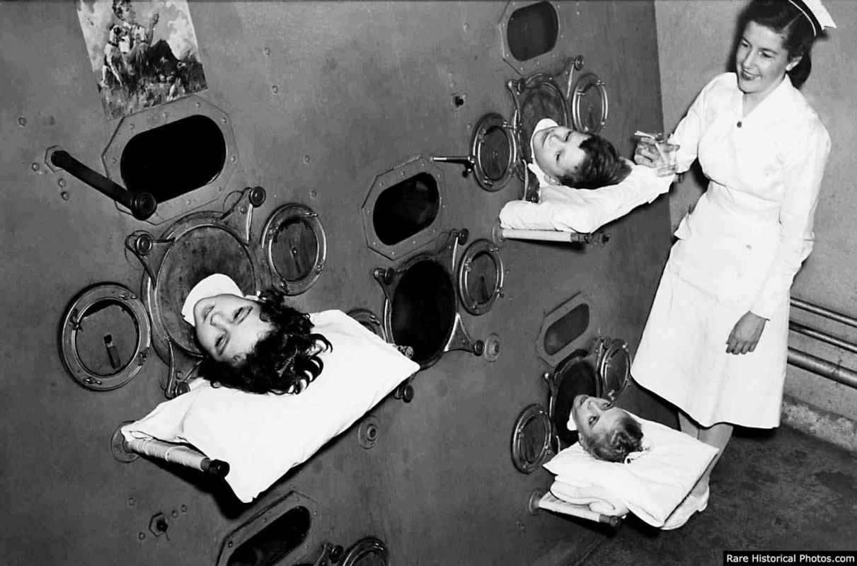 Children in an iron lung before polio vaccination, 1950