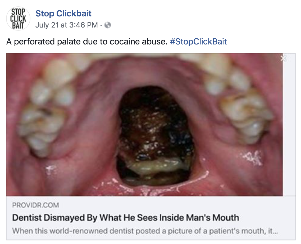 Stop clickbait is doing god's work