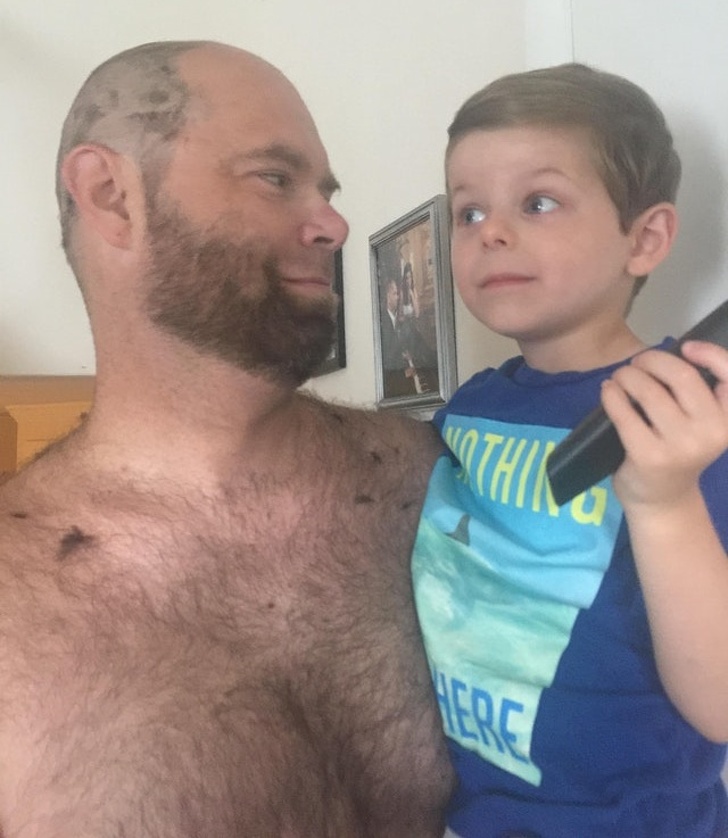 “$10,000 hair implants and a priceless haircut from my 4-year-old son”