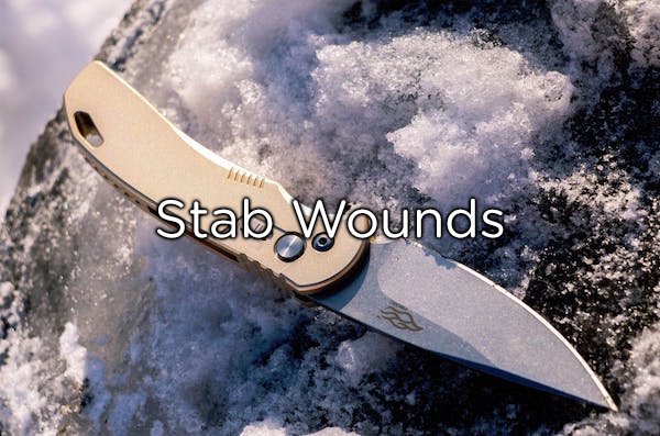 Do not pull objects (knife, glass, splinter, etc.) from a deep wound. They might be sealing or slowing flow from an artery, or they might cut an artery when you pull them out. Put pressure around such an object to slow the bleeding until emergency responders take over.