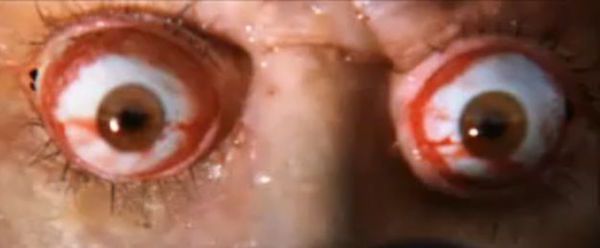 When Max awakes after his fever dream, the last thing he sees is a pair of eyes popping out of a face in an almost comical manner. This exact footage is from the original Mad Max film, when Toecutter is killed.
