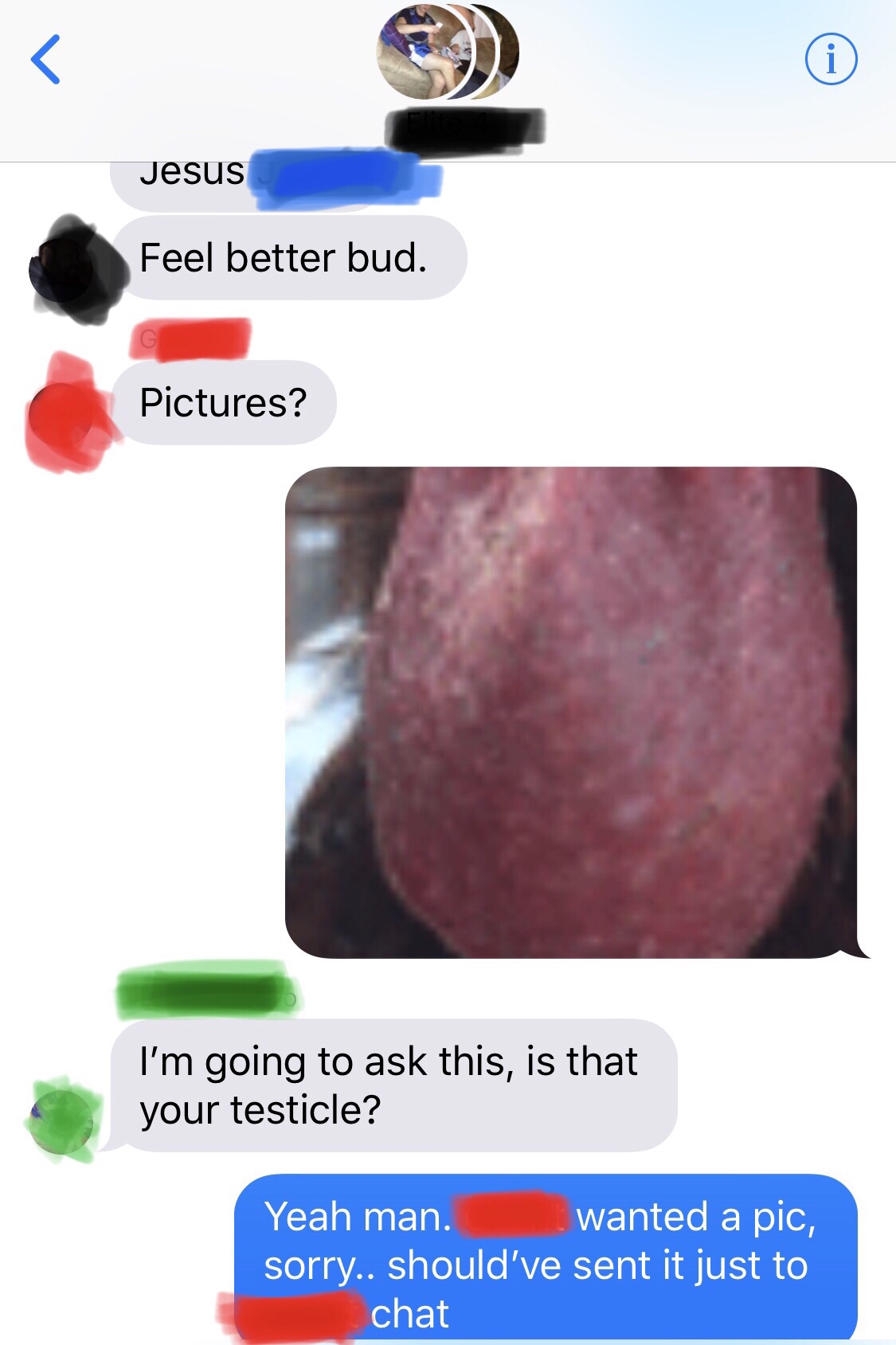 complications after vasectomy - Jesus Feel better bud. Pictures? I'm going to ask this, is that your testicle? Yeah man. wanted a pic, sorry.. should've sent it just to chat