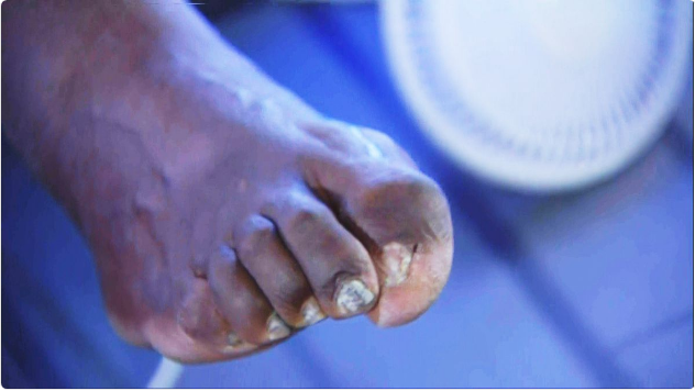 Shaquille O’Neal’s toes
