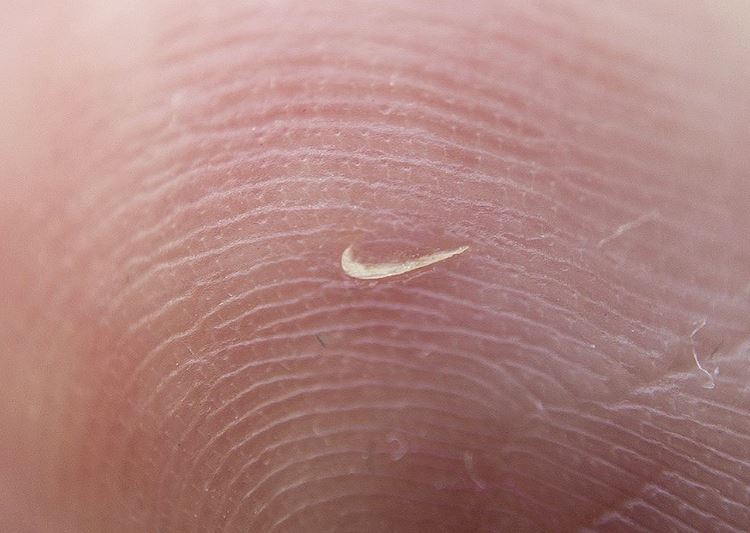 Nike logo scar