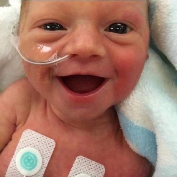 “Our first daughter at 5 days old. 3 lb 14 oz. She was happy to be alive!”