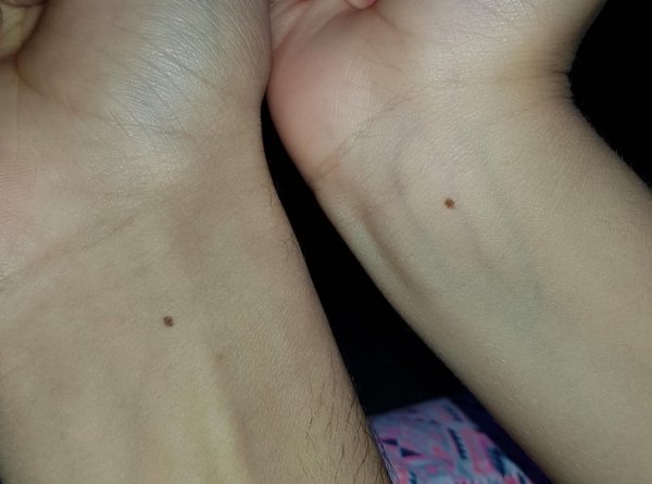 “My sister and I have a freckle in the exact same place.”