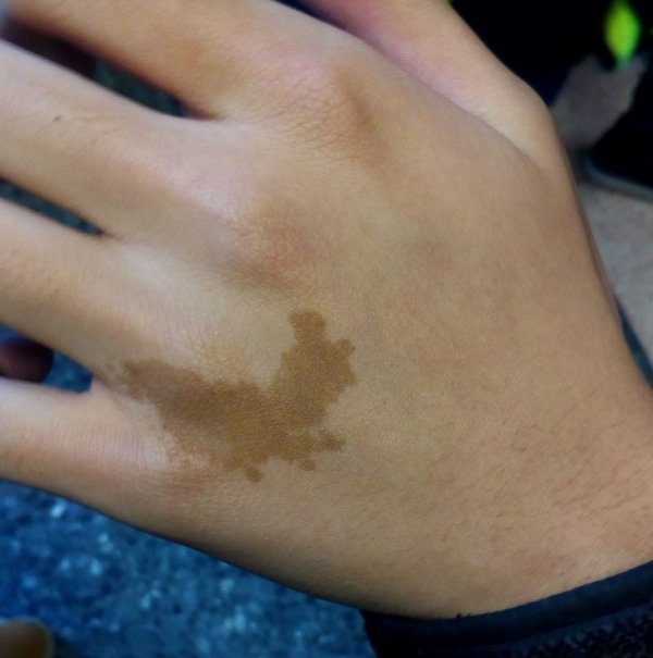 “My Chinese friend has a birthmark shaped like China.”