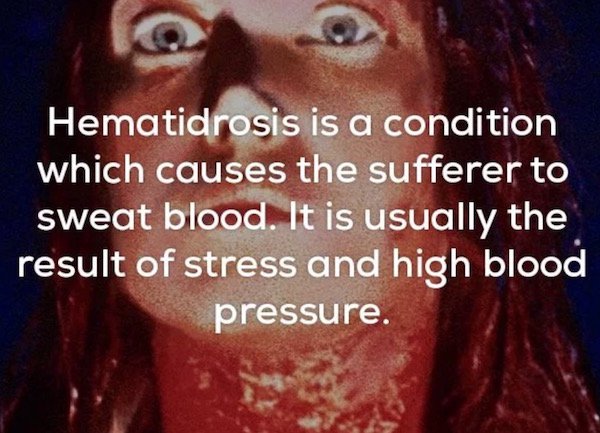 they re all gonna laugh at you - Hematidrosis is a condition which causes the sufferer to sweat blood. It is usually the result of stress and high blood pressure.