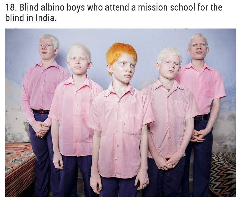 blind albino - 18. Blind albino boys who attend a mission school for the blind in India.