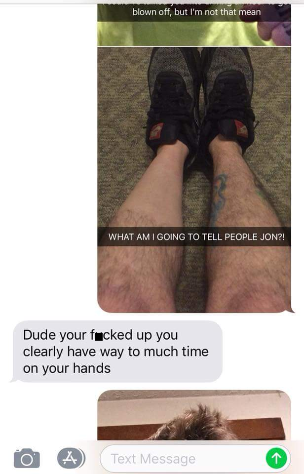 arm - blown off, but I'm not that mean What Am Going To Tell People Jon?! Dude your fucked up you clearly have way to much time on your hands 4 Text Message