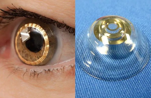 Telescopic contact lenses allow wearers to magnify an object three times its size.