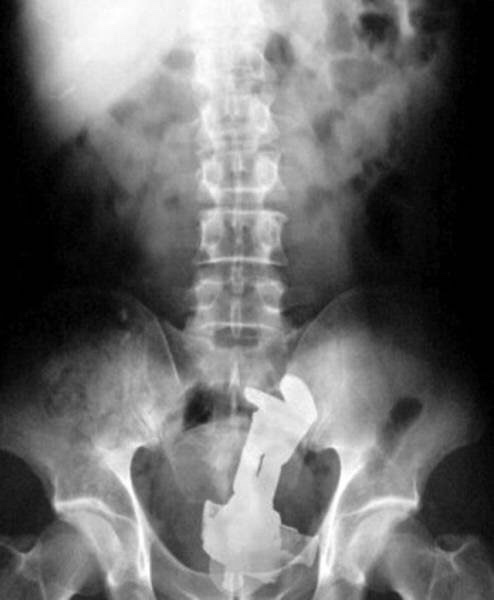 21 WTF x-rays