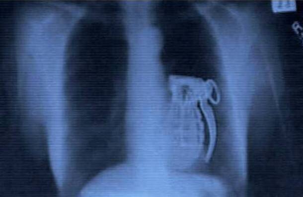 21 WTF x-rays