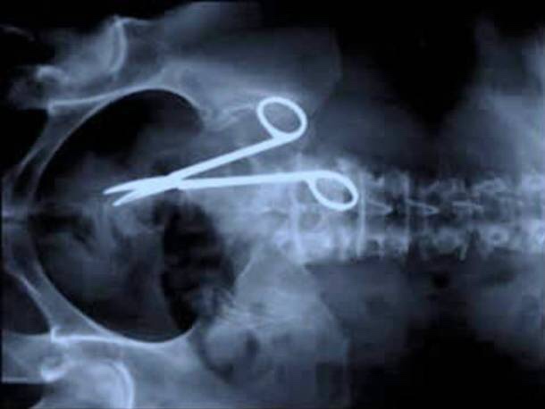 21 WTF x-rays