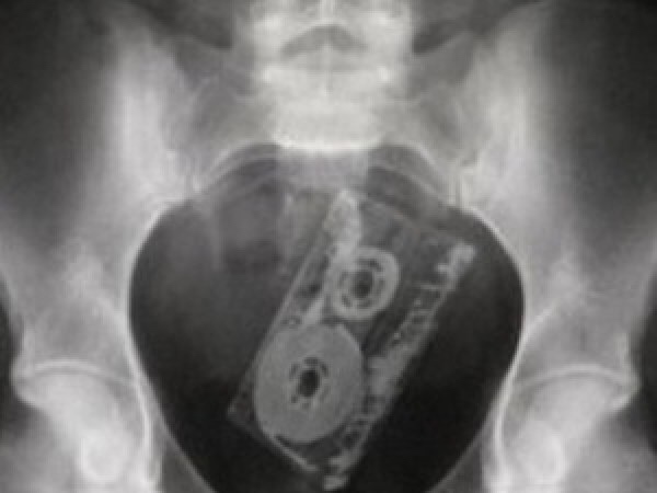 21 WTF x-rays