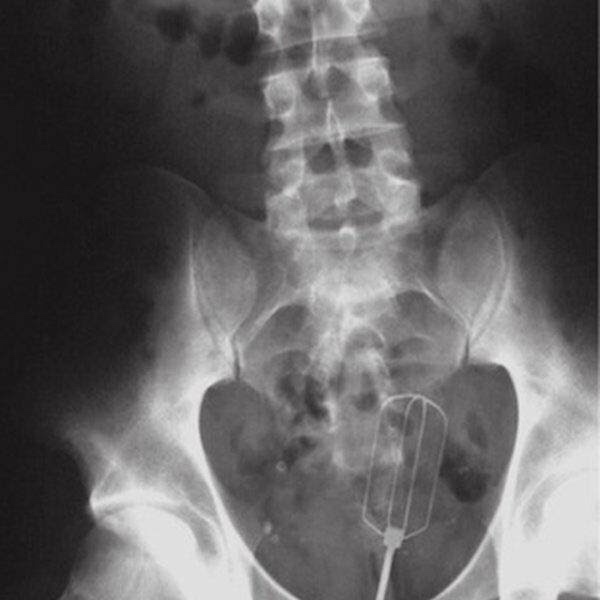 21 WTF x-rays