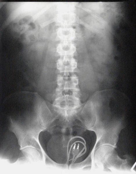 21 WTF x-rays