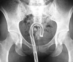 21 WTF x-rays