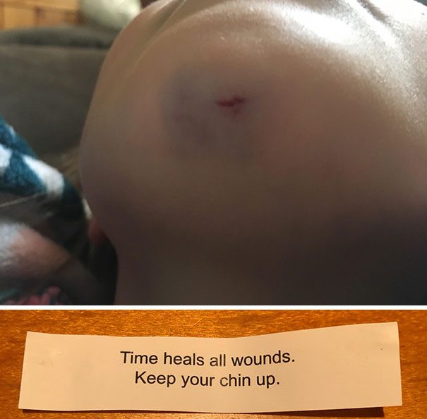 My Daughter Injured Her Chin Today And At Dinner Received This Fortune Cookie