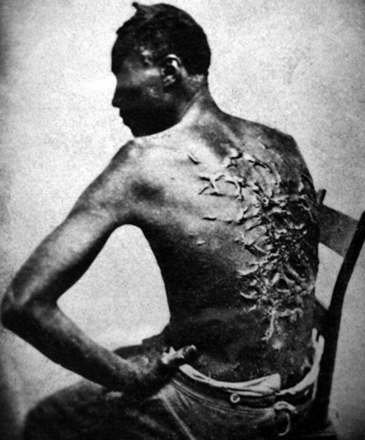 A former slave named Gordon shows his whipping scars. Baton Rouge, Louisiana, 1863