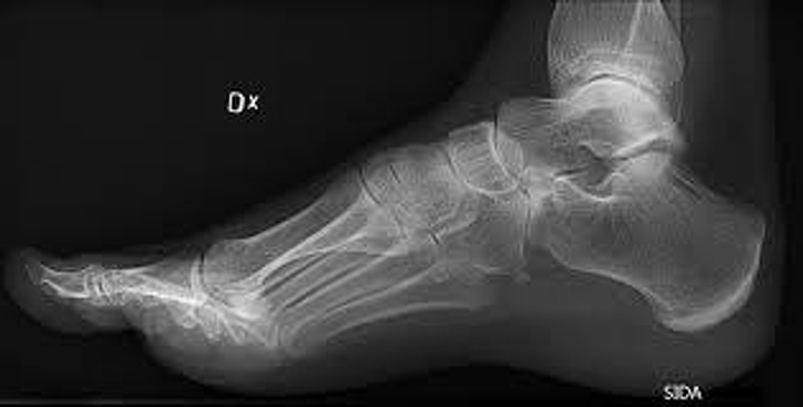 Nevada: No one can use an X-ray machine to estimate a person’s shoe size.