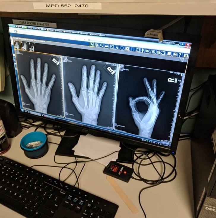 wtf pulled a fast one on my x ray technician