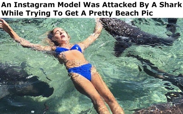 shark bite - An Instagram Model Was Attacked By A Shark While Trying To Get A Pretty Beach Pic