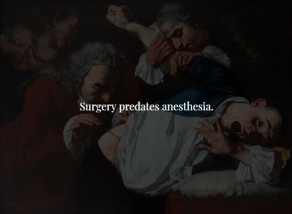 middle ages surgery - Surgery predates anesthesia.