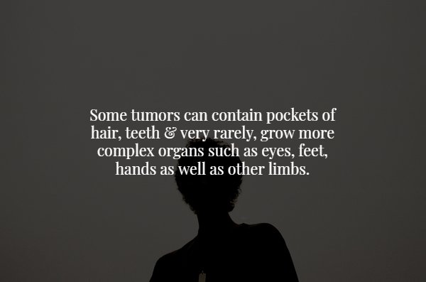 presentation - Some tumors can contain pockets of hair, teeth & very rarely, grow more complex organs such as eyes, feet, hands as well as other limbs.
