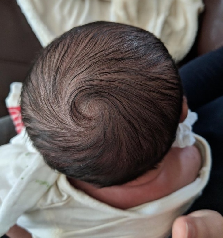 “My newborn son’s hair whirl”