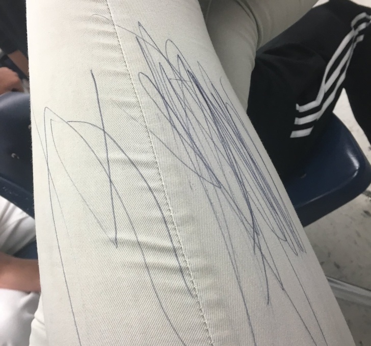 scratching my leg with a pen