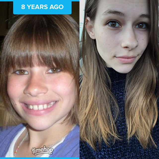 transformations - people who used to be ugly - 8 Years Ago timehop