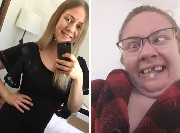 before and after pics - ugly people with glasses