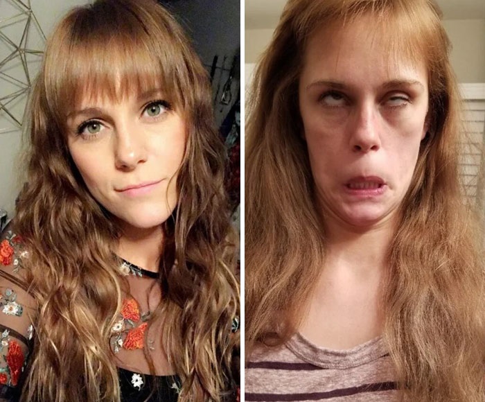 before and after pics - ugly girl
