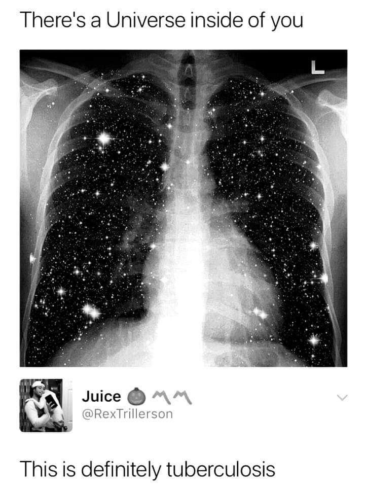 memes - you have tuberculosis meme - There's a Universe inside of you Juice Om This is definitely tuberculosis