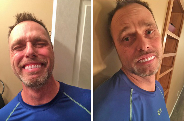 “My dad ordered fake teeth to improve his smile just as the description said...”