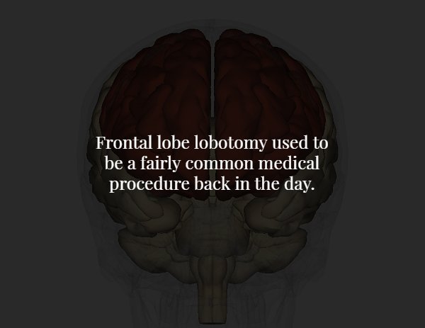 brain - Frontal lobe lobotomy used to be a fairly common medical procedure back in the day.
