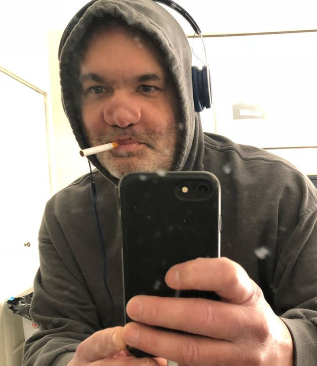 Comedian Artie Lange’s nose after snorting cocaine and glass