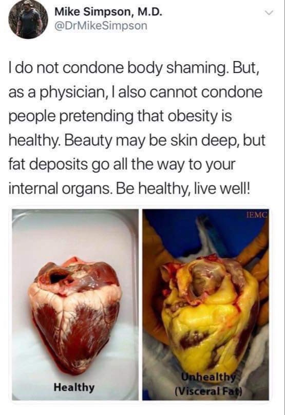 visceral fat on heart - Mike Simpson, M.D. Simpson I do not condone body shaming. But, as a physician, I also cannot condone people pretending that obesity is healthy. Beauty may be skin deep, but fat deposits go all the way to your internal organs. Be he
