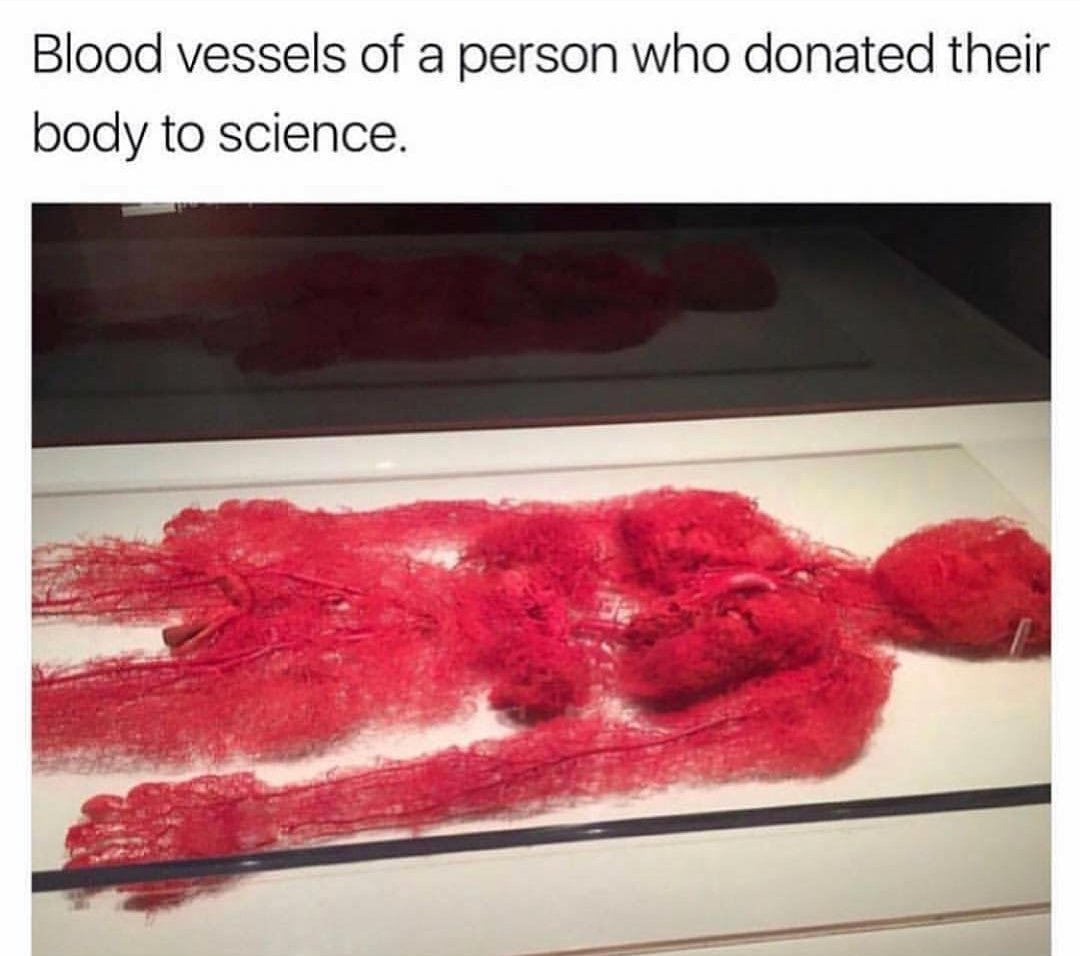 blood vessels of body donated to science - Blood vessels of a person who donated their body to science.