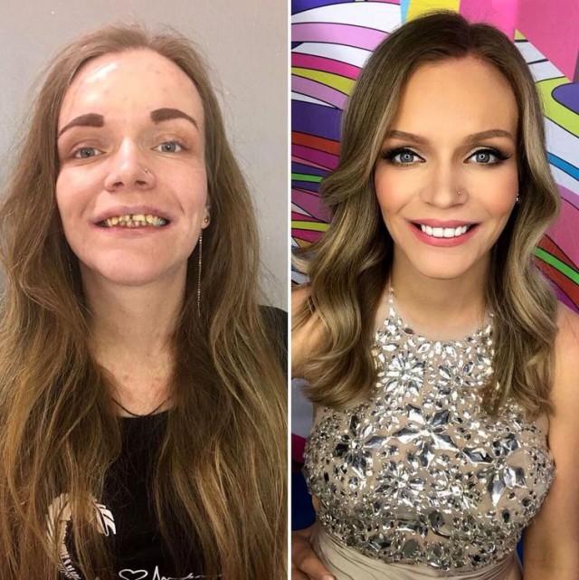 23 Times Make-up Pulled a Miracle