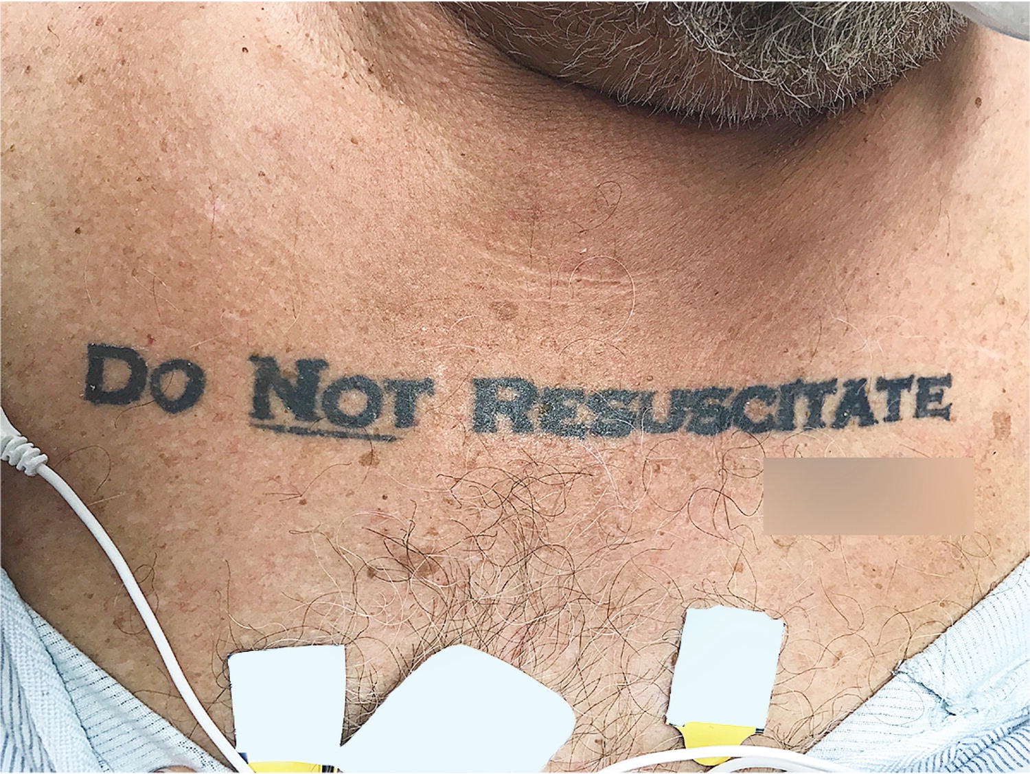 dnr tattoo - Do Not Resuscitate